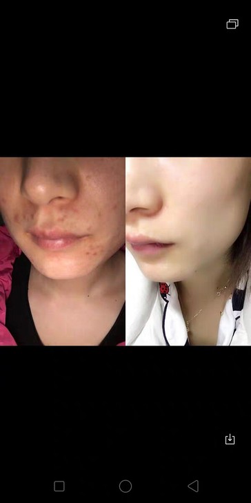 #家里放不下#朵颜面霜正品 本人代理转让存...